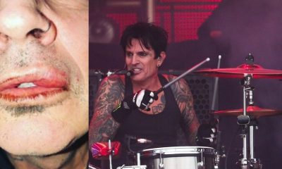 Tommy Lee assaulted by his own son