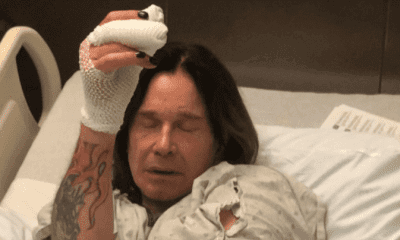 Ozzy Osbourne after hand surgery