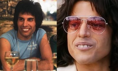 Freddie Mercury teeth