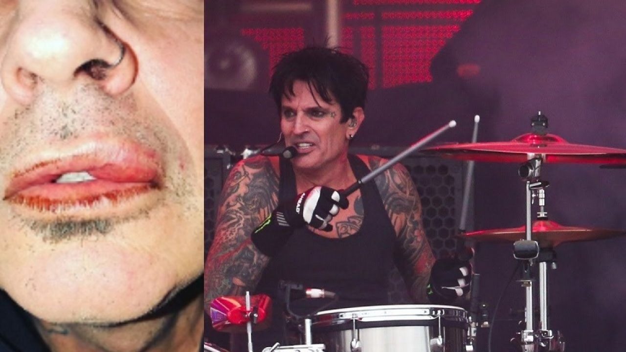 Motlëy Crue's drummer Tommy Lee is assaulted by his own son