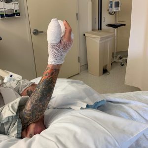Ozzy Osbourne hand surgery