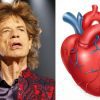 Mick Jagger Heart Surgery