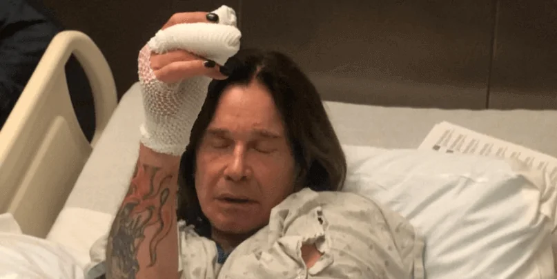 Ozzy Osbourne after hand surgery
