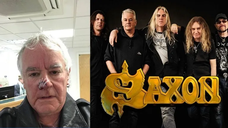 Saxon Drummer bitten by a dog
