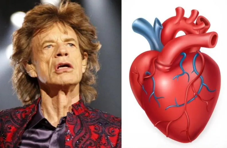 Mick Jagger Heart Surgery