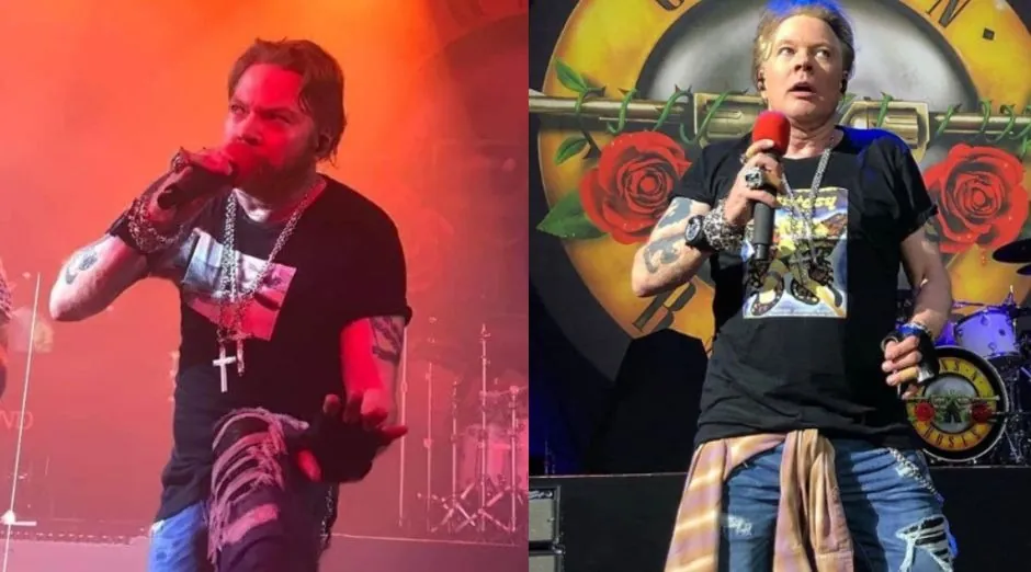 Axl Rose short hair